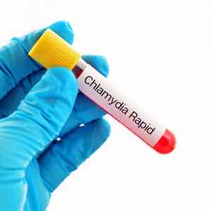 Instant Chlamydia rapid test